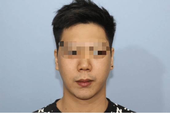越南 Ngoc Bao Biomedical PEEK 植入物应用案例